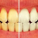 چه چیزی دندان های مان را زرد می‌کند؟